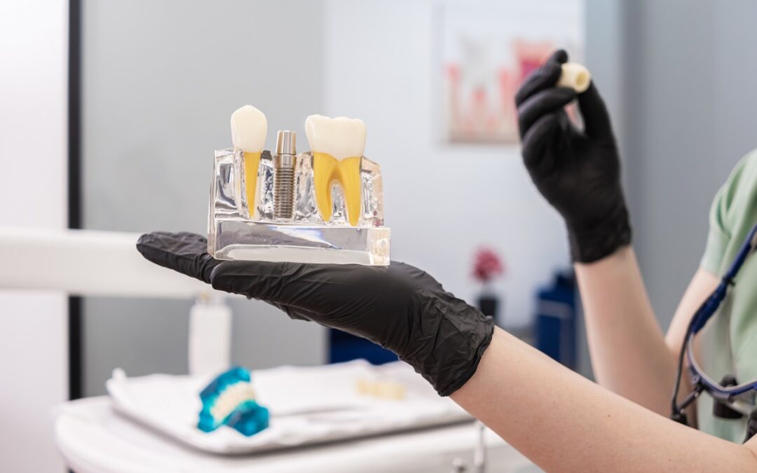 how implant technology has changed treatment timelines